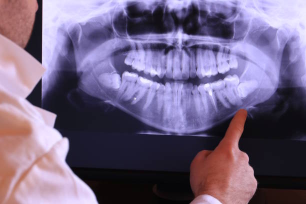 Best Emergency Dentist for Lost Fillings or Crowns in Glide, OR