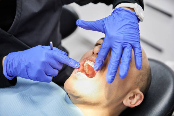 Best Emergency Dentist for Lost Fillings or Crowns in Glide, OR